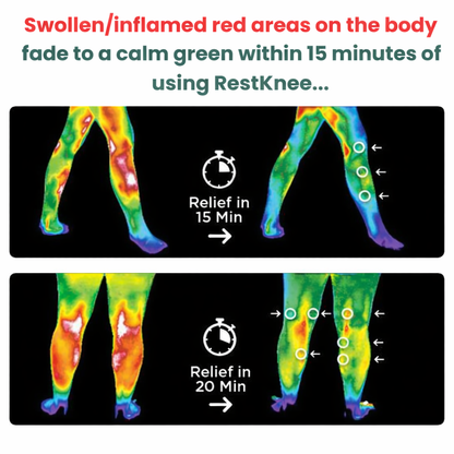 RestKnee™ Massager